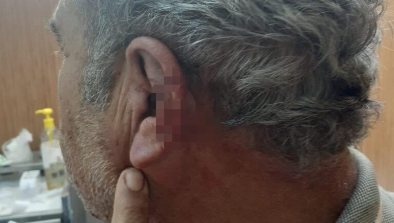 aile hekimi ile emekli ogretmenin mesai kavgasikarakolda bitti InhmSdxP