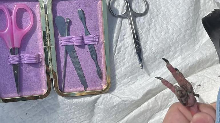 Güvercinlerin yaralı ayakları